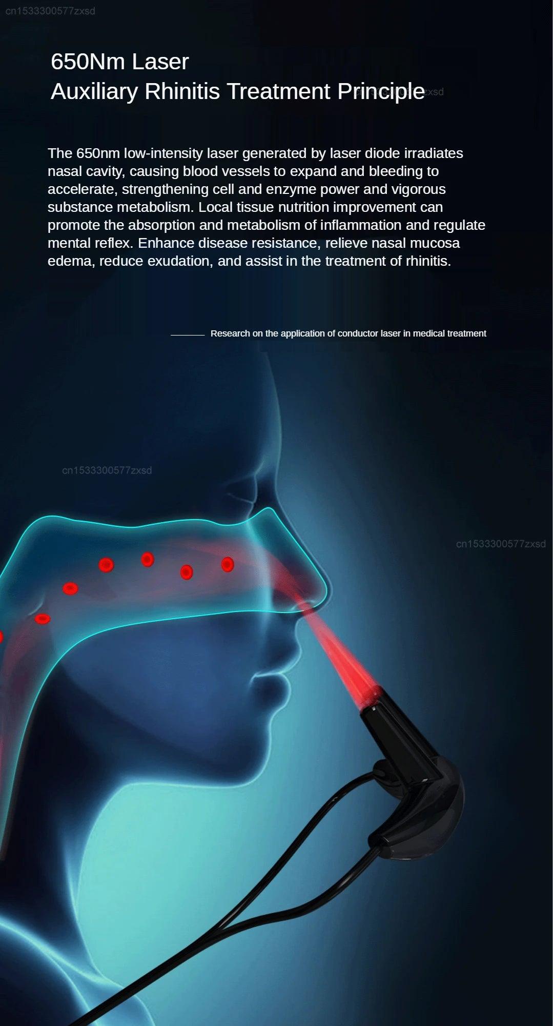 Xiaomi ZDEER Portable Laser Therapy Device for Rhinitis Treatment